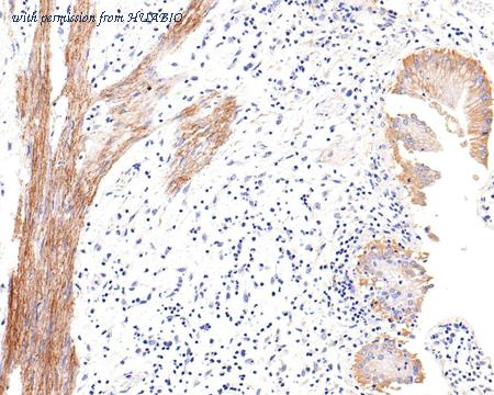 HUABIO HA721165 image 2