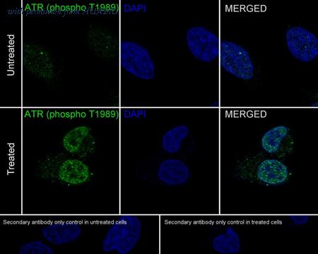 HUABIO HA721190 image 2
