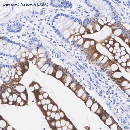 HUABIO HA721194 image 1