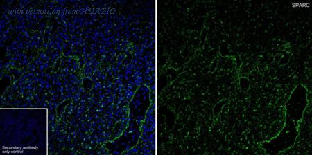 HUABIO HA721199 image 1