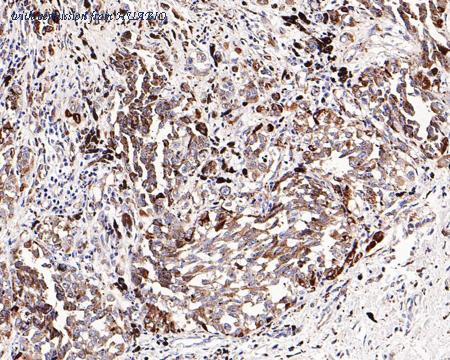 HUABIO HA721199 image 2