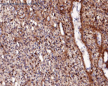 HUABIO HA721199 image 3