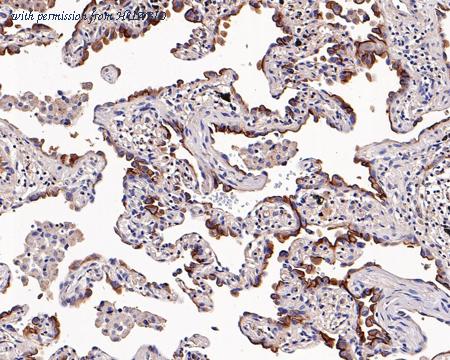 HUABIO HA721200 image 1