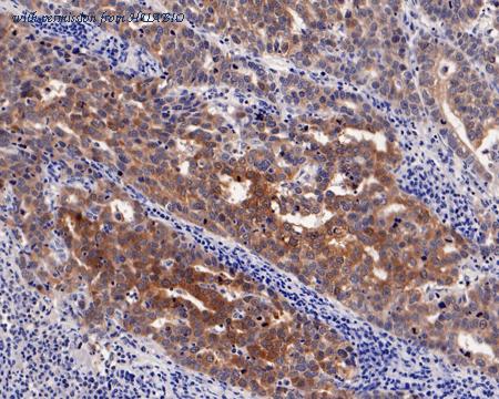 HUABIO HA721204 image 2