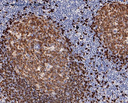 HUABIO HA721207 image 2