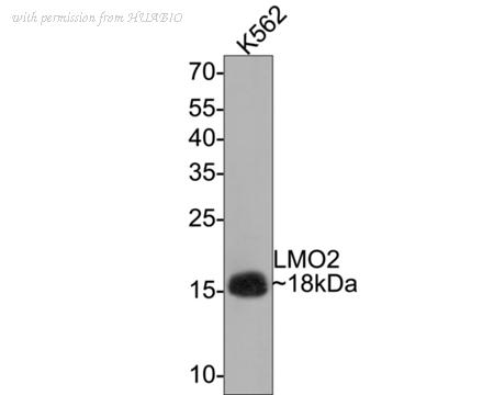 HUABIO HA721212 image 1