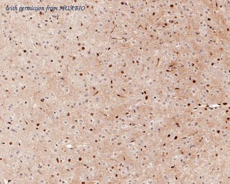 HUABIO HA721212 image 2