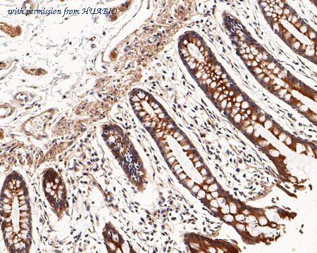 HUABIO HA721215 image 3