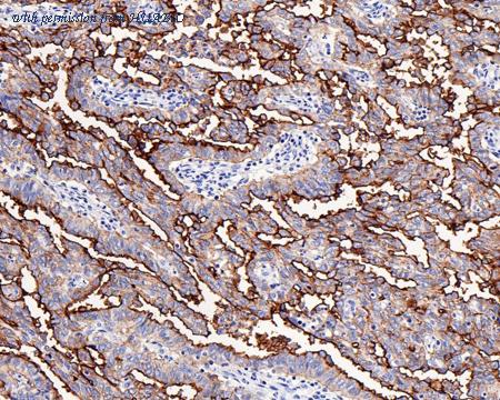 HUABIO HA721217 image 1