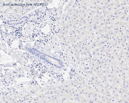 HUABIO HA721217 image 3