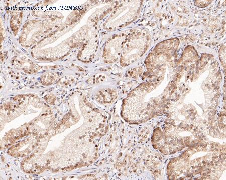 HUABIO HA721260 image 2