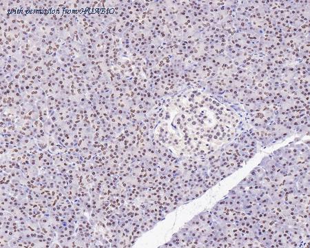 HUABIO HA721303 image 2