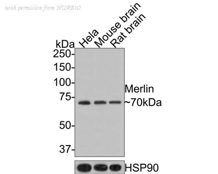 HUABIO HA721320 image 1