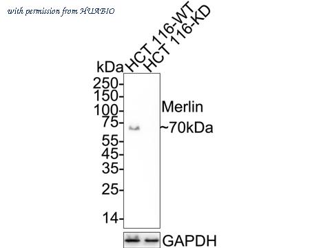 HUABIO HA721320 image 2