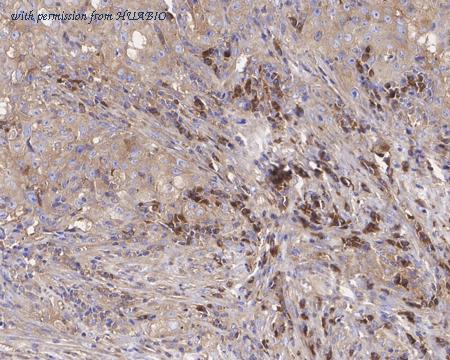 HUABIO HA721370 image 3