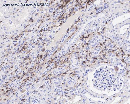 HUABIO HA721371 image 3