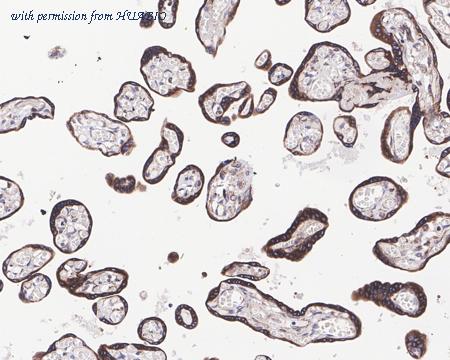 HUABIO HA721380 image 3