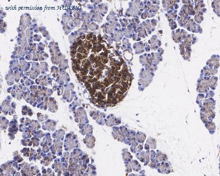 HUABIO HA721423 image 2