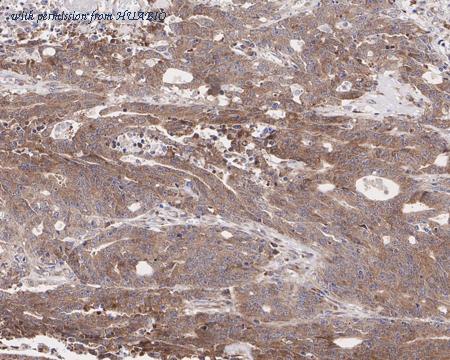 HUABIO HA721435 image 2