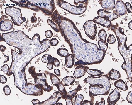 HUABIO HA721437 image 1