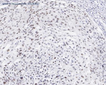 HUABIO HA721447 image 2