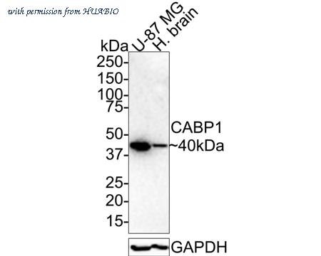 HUABIO HA721448 image 1