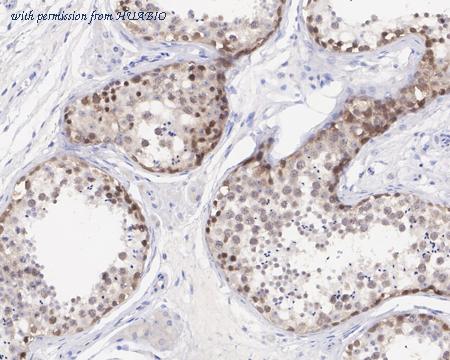 HUABIO HA721457 image 2