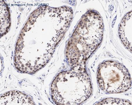 HUABIO HA721458 image 2