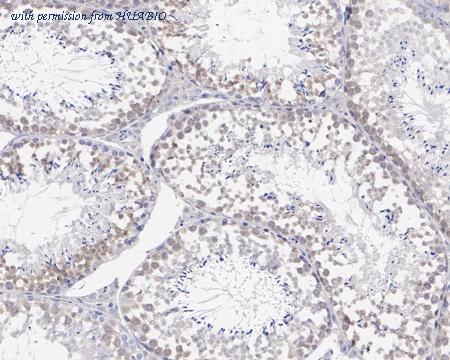 HUABIO HA721458 image 3