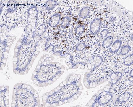 HUABIO HA721459 image 1