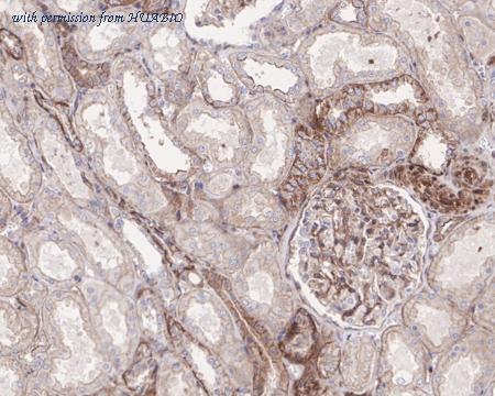 HUABIO HA721464 image 3