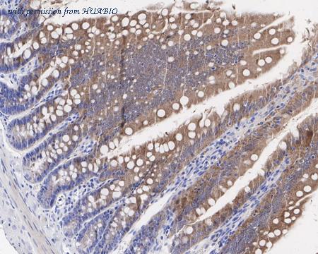 HUABIO HA721472 image 3