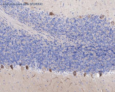 HUABIO HA721478 image 2