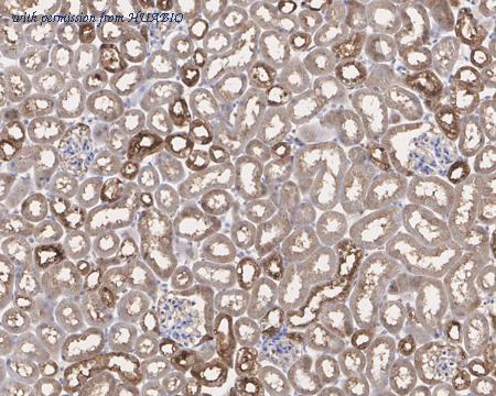 HUABIO HA721525 image 2