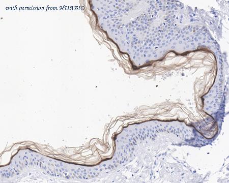 HUABIO HA721547 image 1