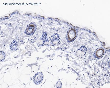 HUABIO HA721547 image 2