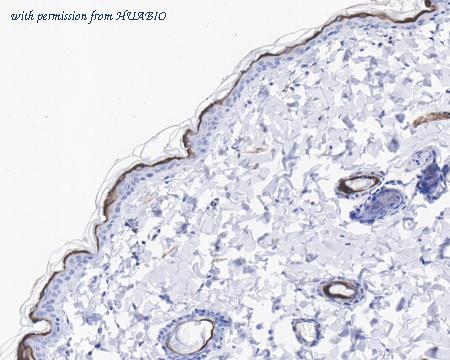 HUABIO HA721547 image 3