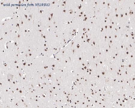 HUABIO HA721549 image 2