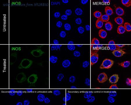 HUABIO HA721583 image 2