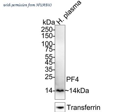 HUABIO HA721584 image 1