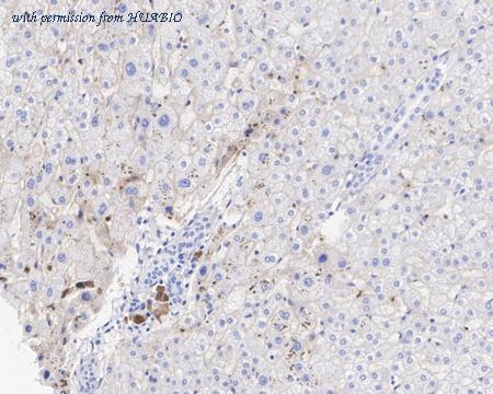 HUABIO HA721584 image 3