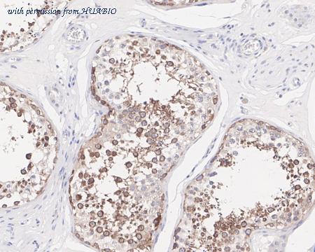 HUABIO HA721594 image 2