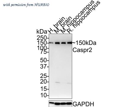 HUABIO HA721598 image 1