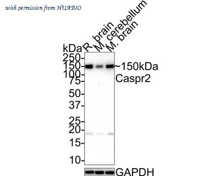 HUABIO HA721598 image 2