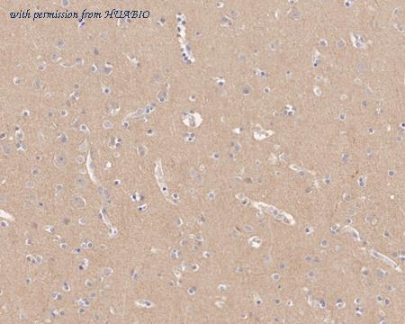 HUABIO HA721598 image 3