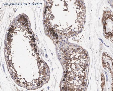 HUABIO HA721621 image 3