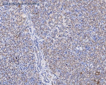 HUABIO HA721635 image 2