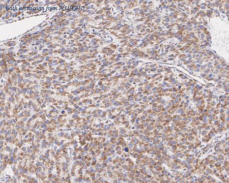 HUABIO HA721636 image 2