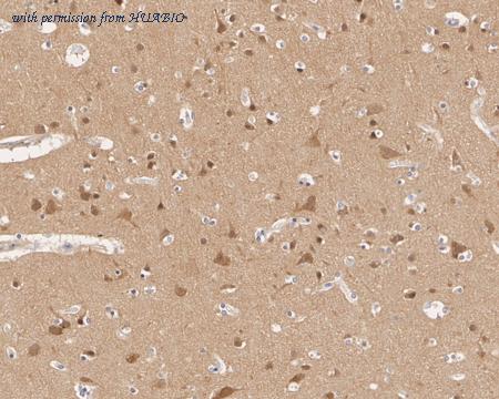 HUABIO HA721639 image 3