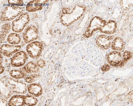 HUABIO HA721645 image 2